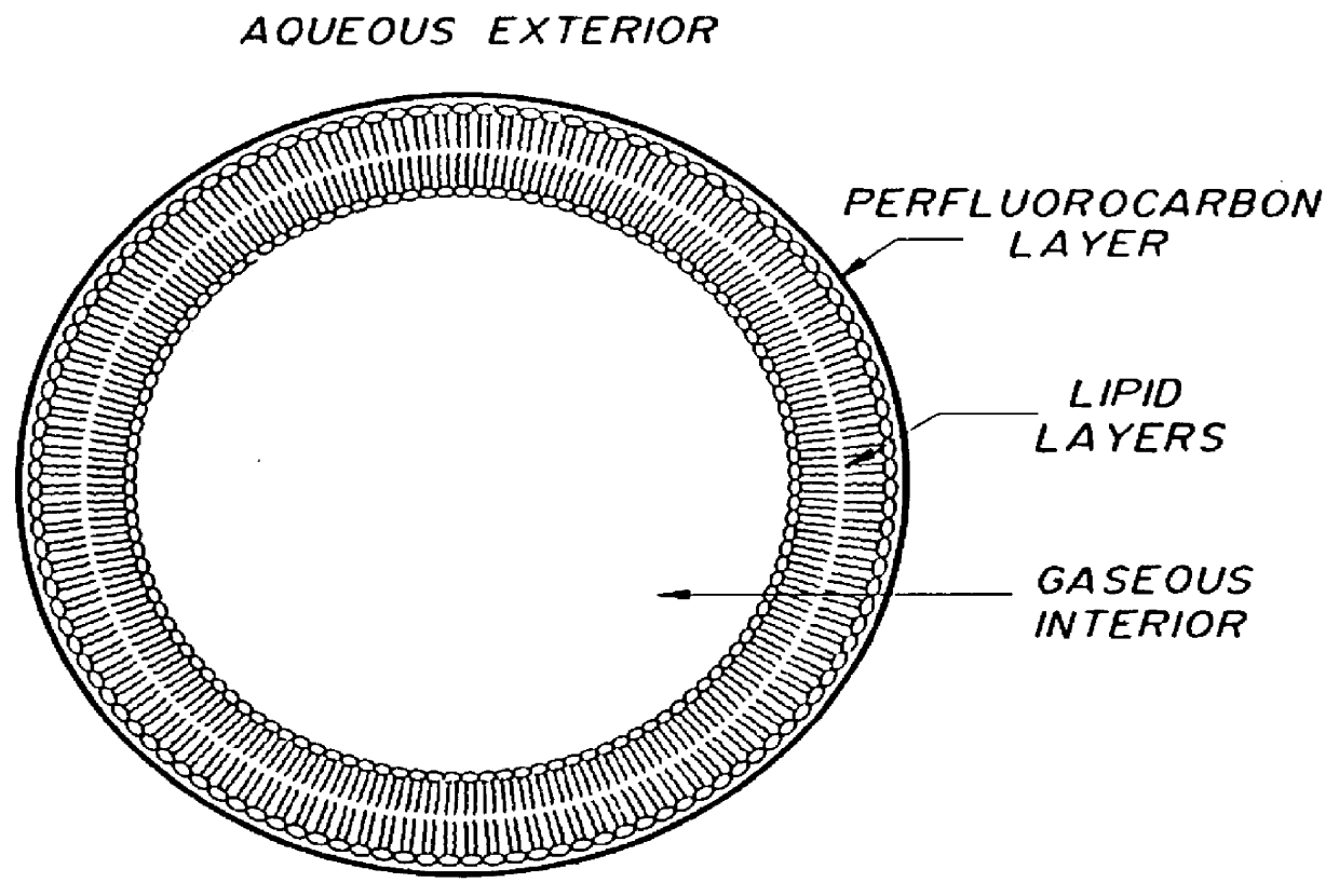 Method of computed tomography using fluorinated gas-filled lipid microspheres as contrast agents