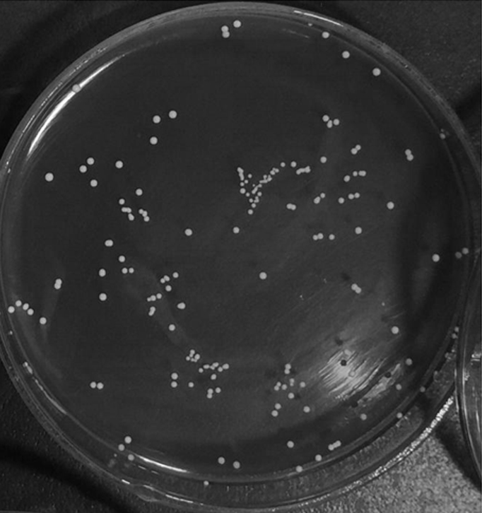 Lactobacillus plantarum with fast acid production and high acid production and application thereof