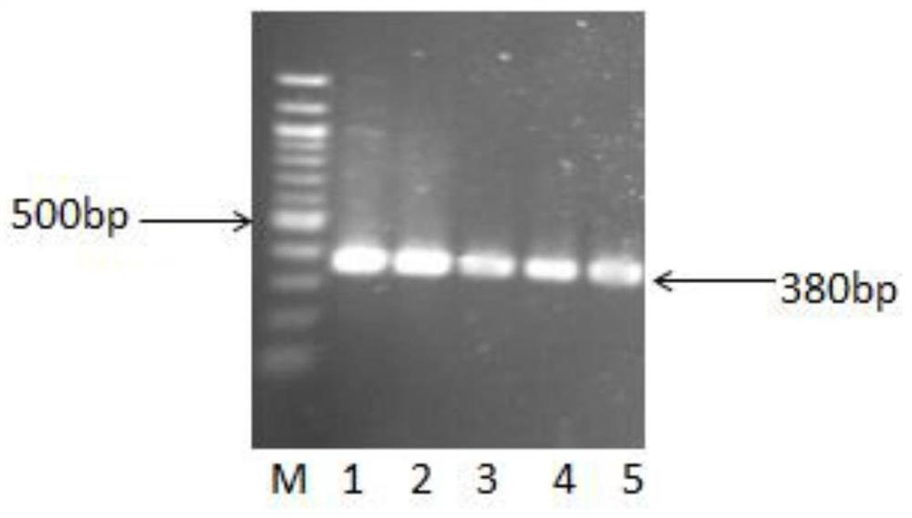 A kind of recombinant vector and its construction method and application