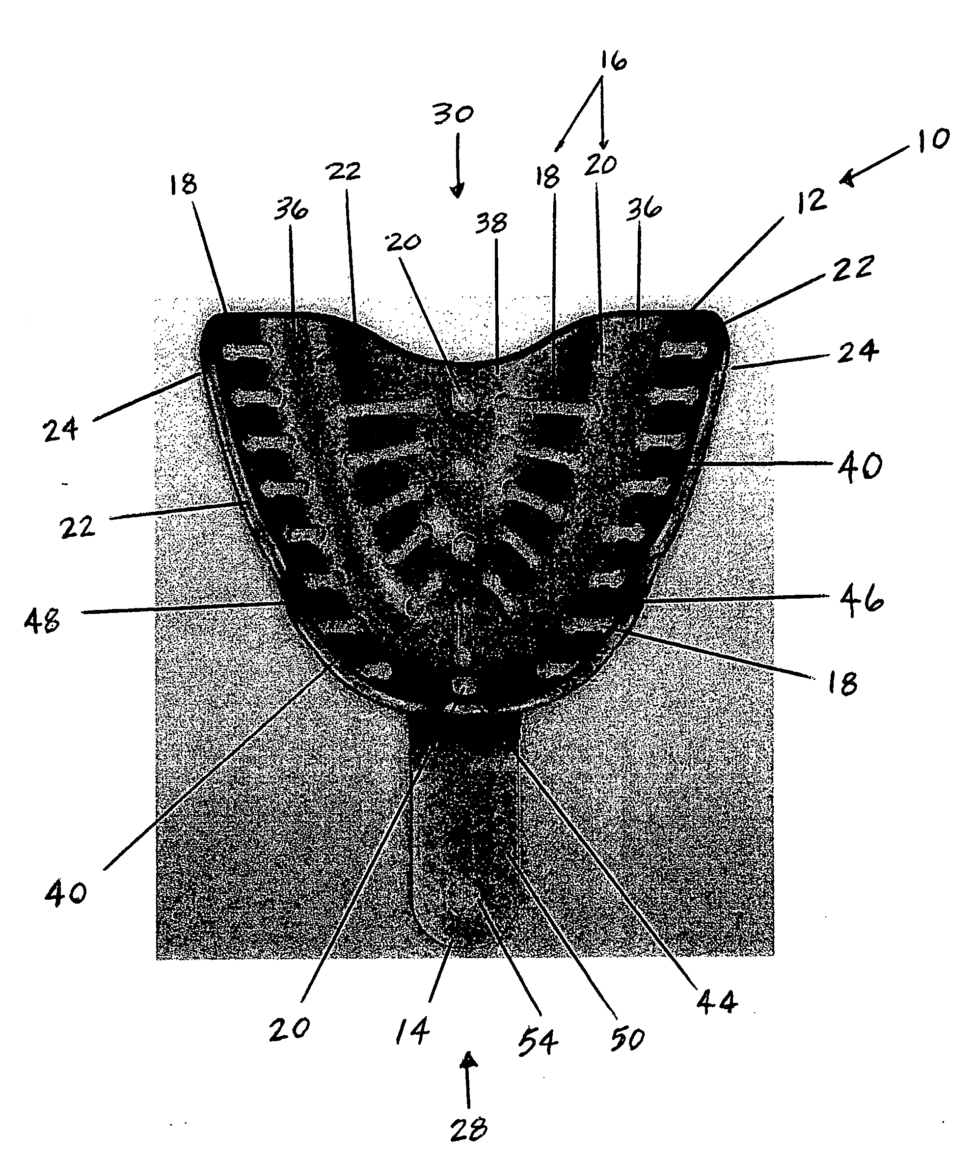 Dental tray for obtaining dental impression of edentulous patient