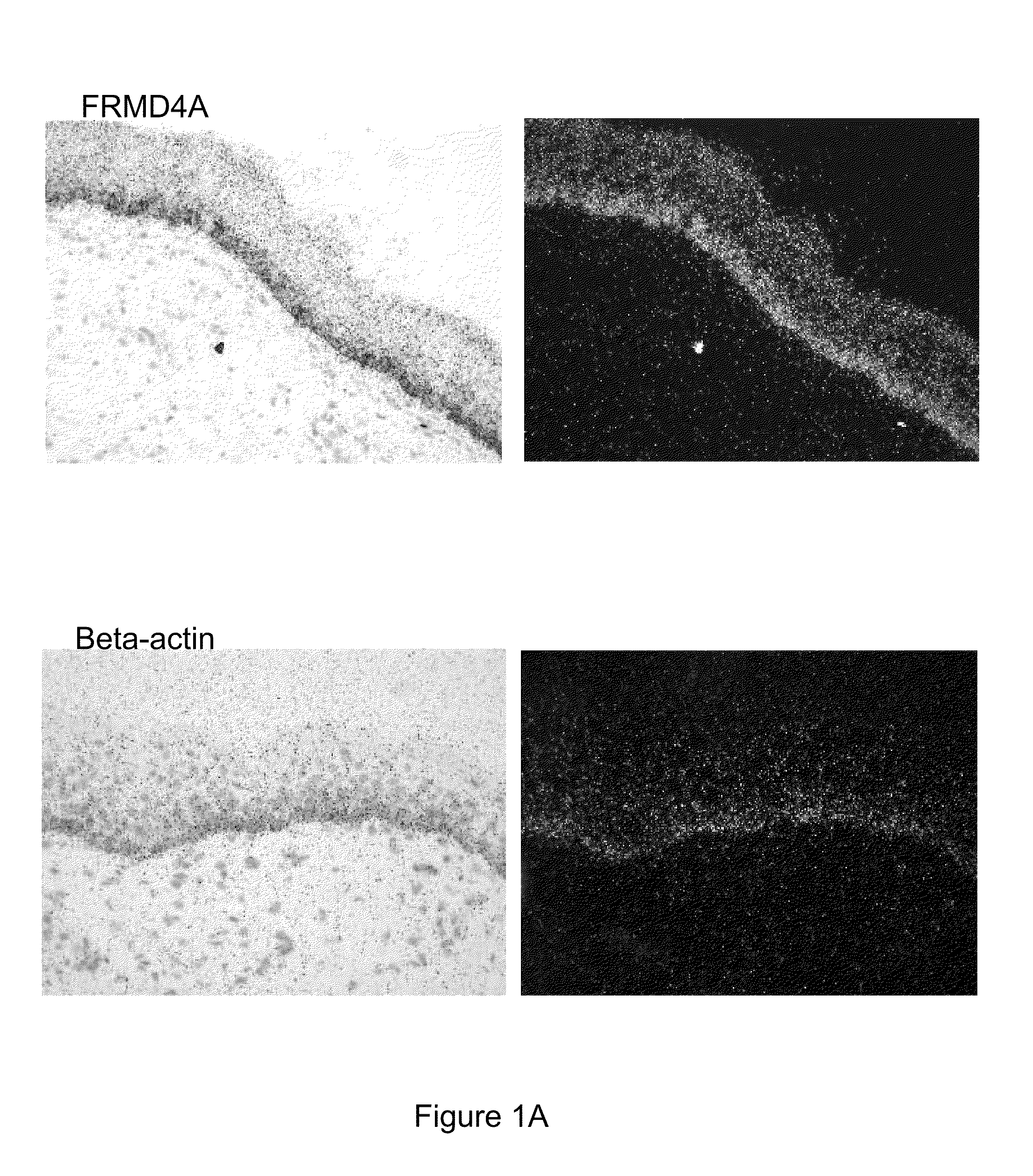 Frmd4a antagonists and their uses