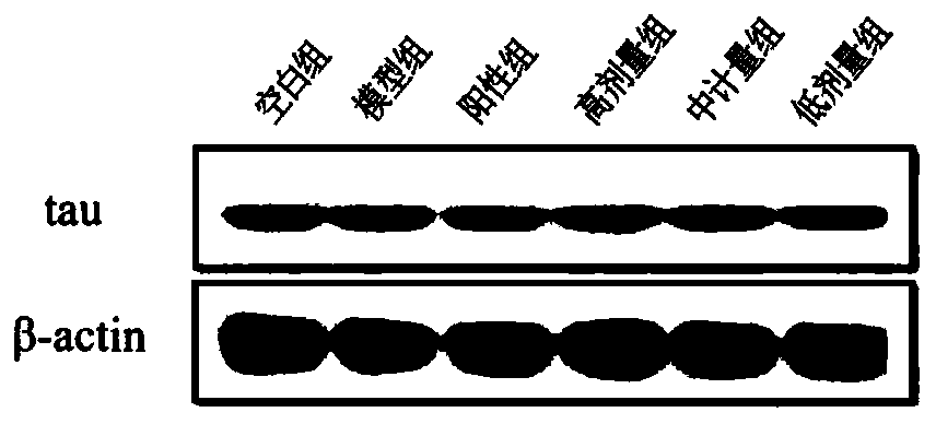 Application of fructus hippophae water-soluble extract for preparing preparation capable of inhibiting phosphorylation of Tau protein