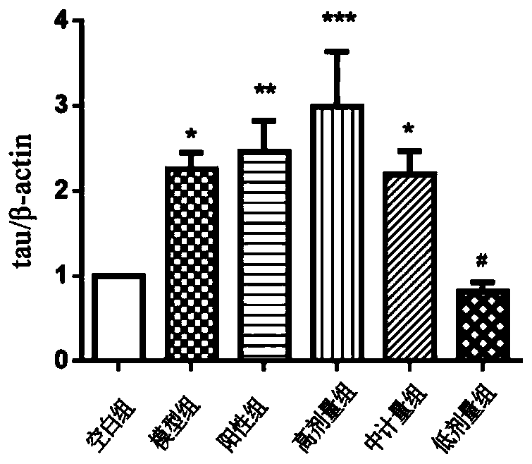 Application of fructus hippophae water-soluble extract for preparing preparation capable of inhibiting phosphorylation of Tau protein