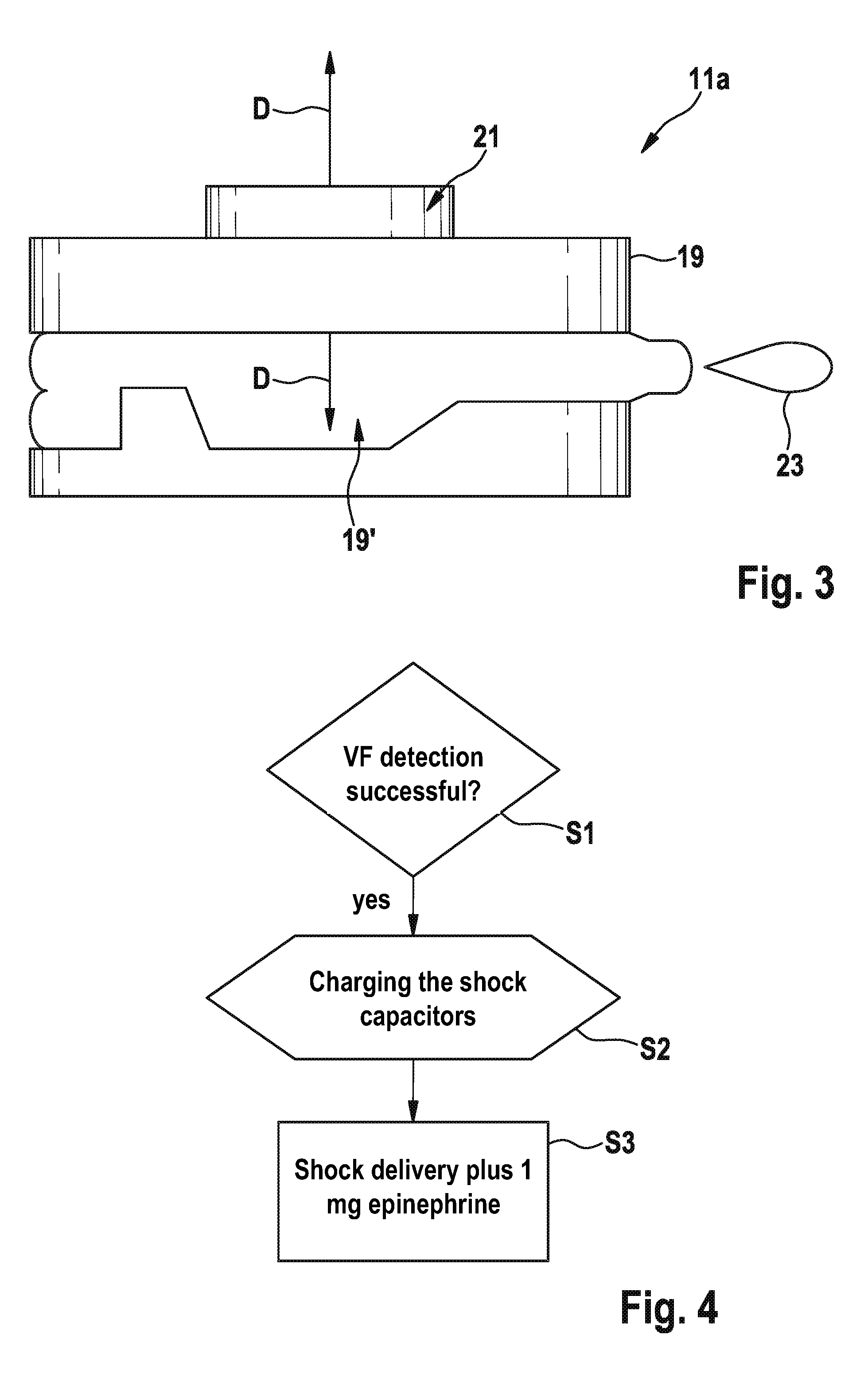 Implantable shock electrode line and implantable defibrillation arrangement