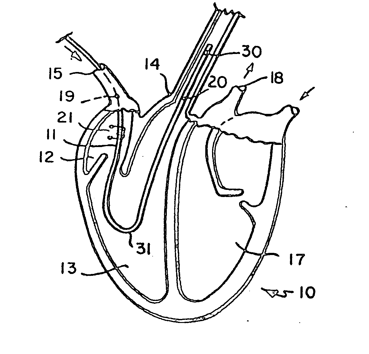 Blood flow monitor with venous and arterial sensors