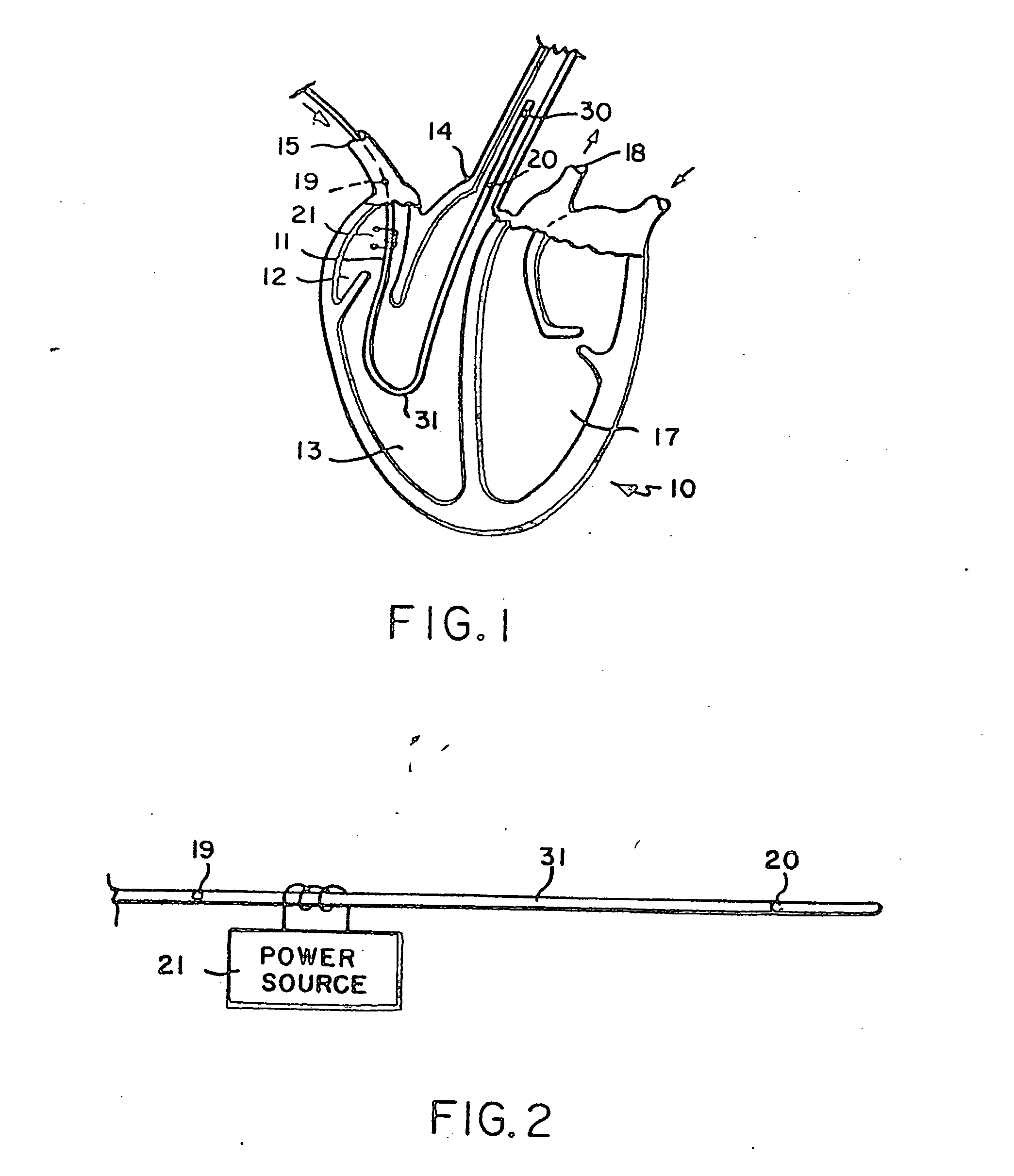 Blood flow monitor with venous and arterial sensors