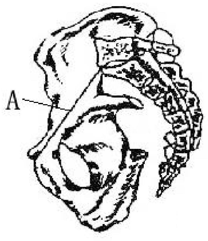 Pelvis model-based parturition axis construction method