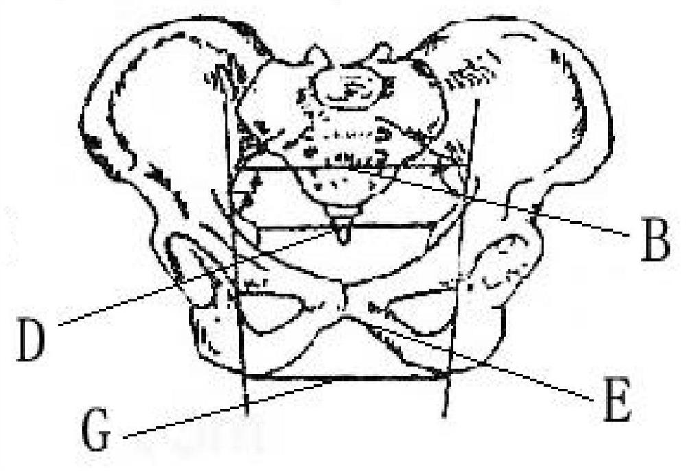 Pelvis model-based parturition axis construction method