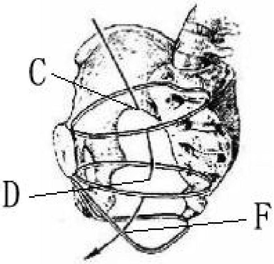 Pelvis model-based parturition axis construction method