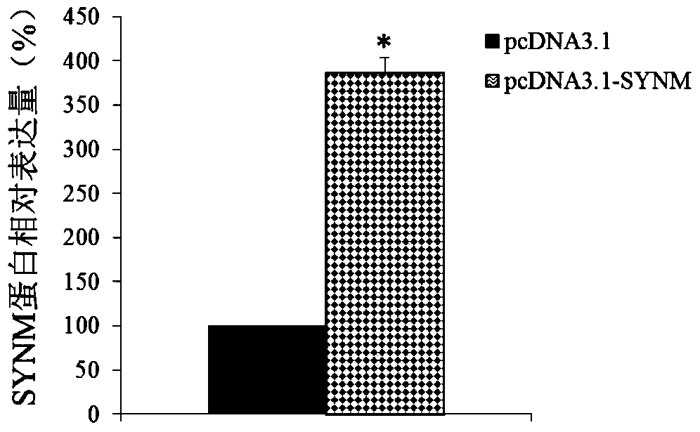 Application of synm in preparation of tools for diagnosing or treating endometrial cancer