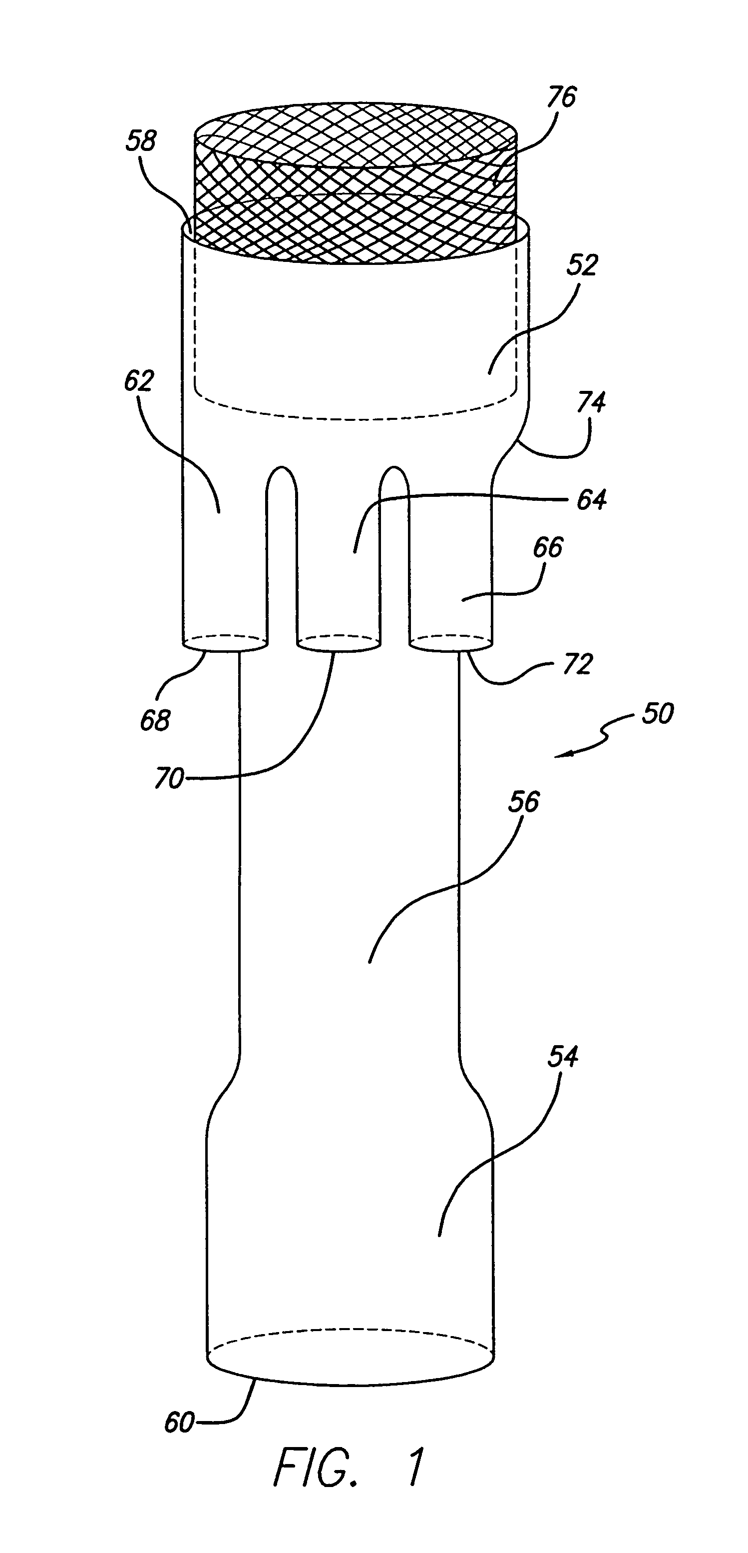 Modular stent-graft for endovascular repair of aortic arch aneurysms and dissections