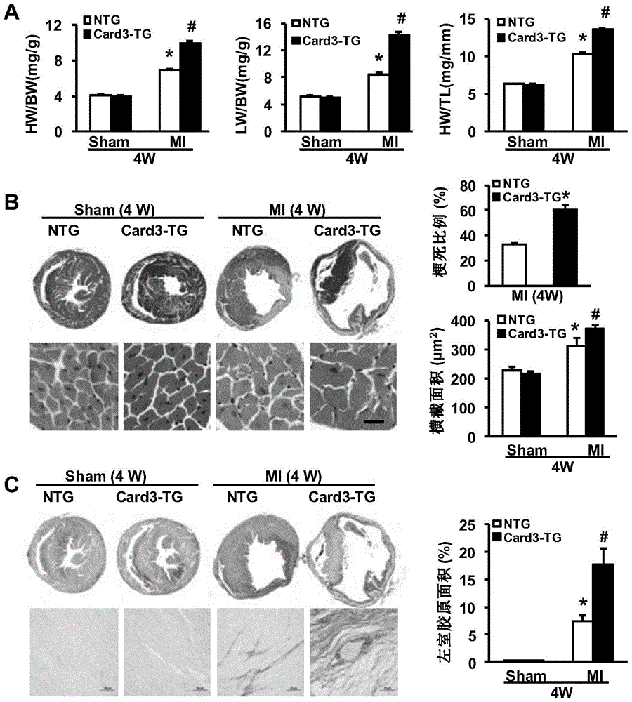 Function and application of caspase activation and recruitment binding domain 3 (card3) gene in coronary atherosclerotic heart disease