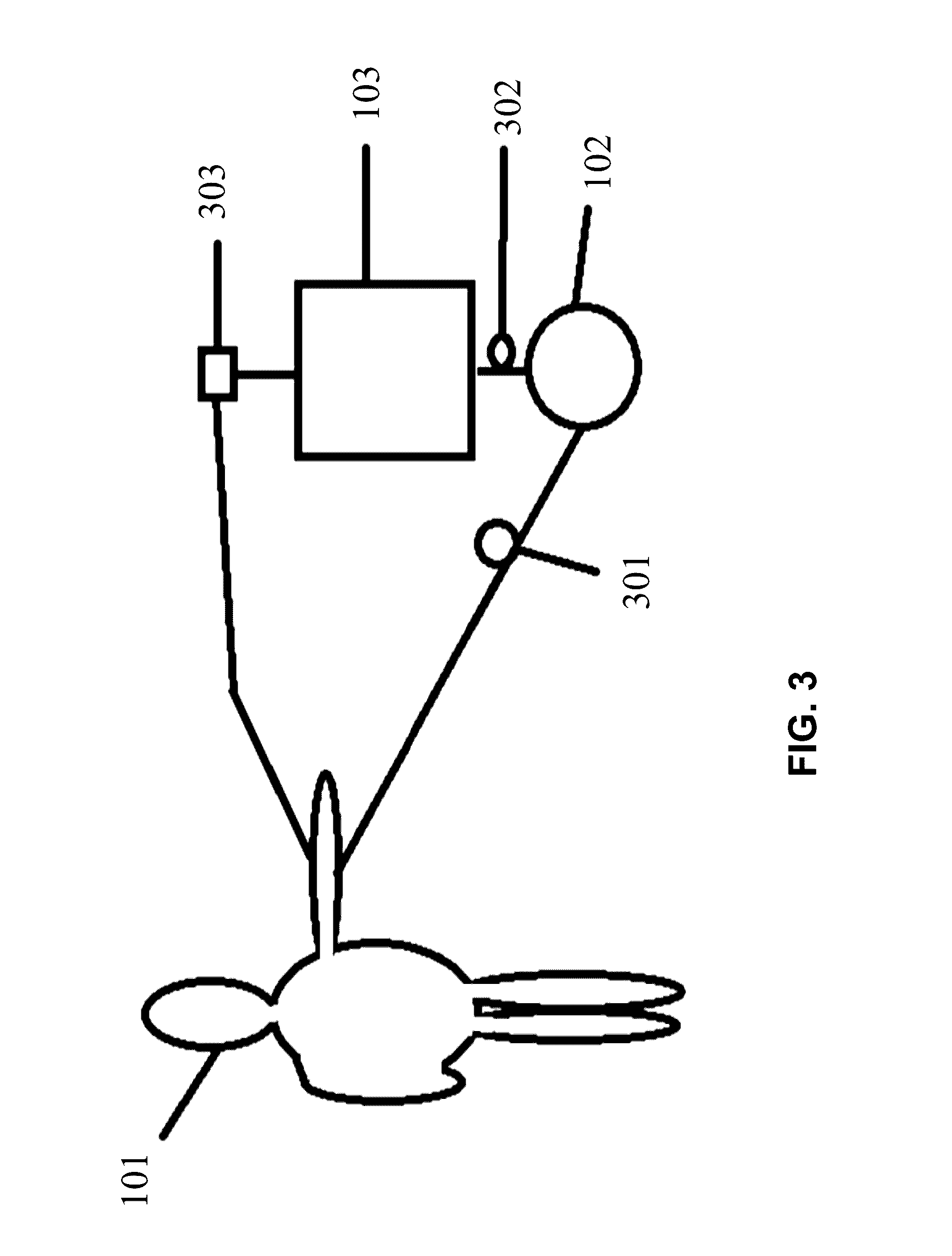 Pre-concertation apparatus & method