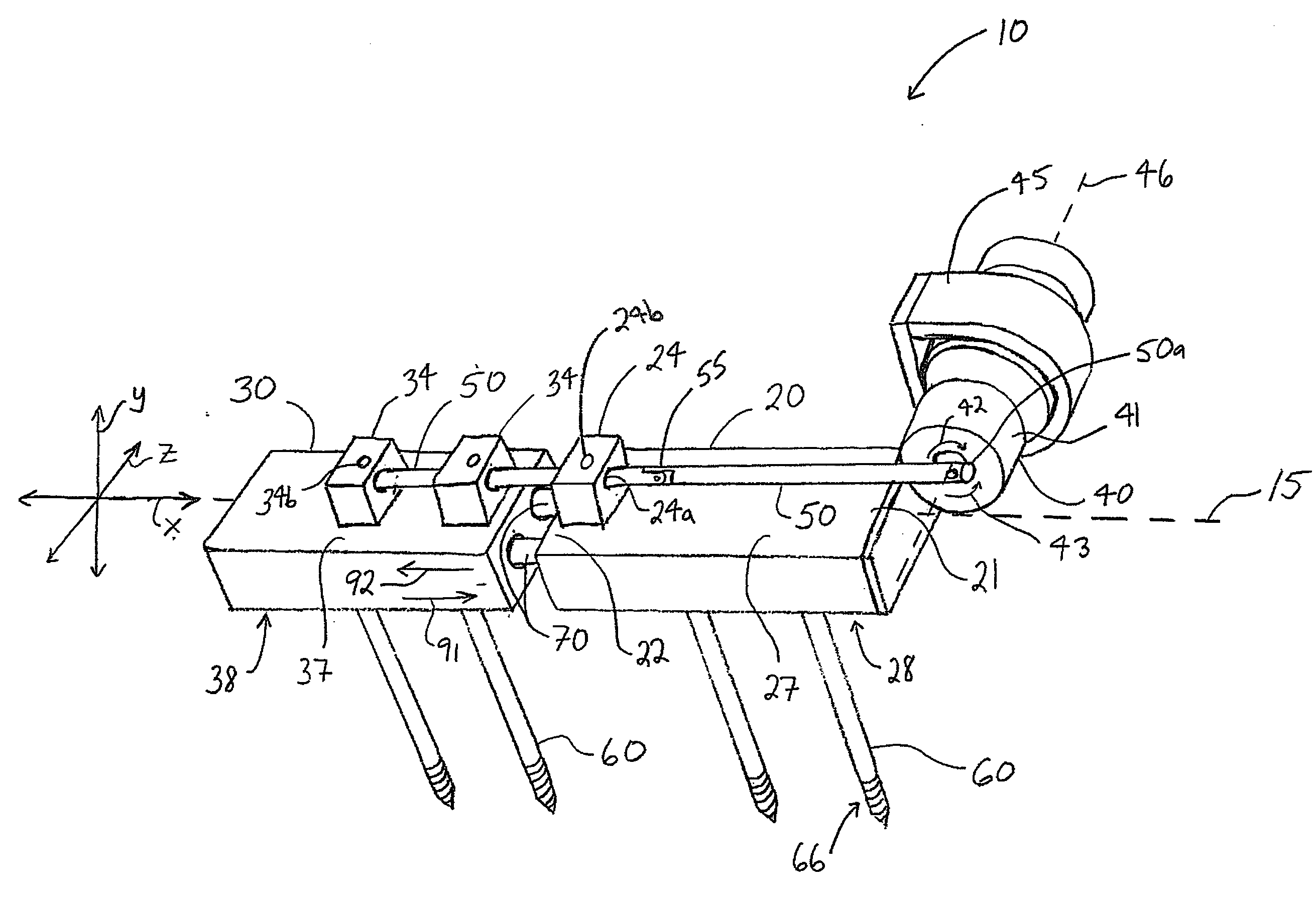 Bone fixation and dynamization devices and methods