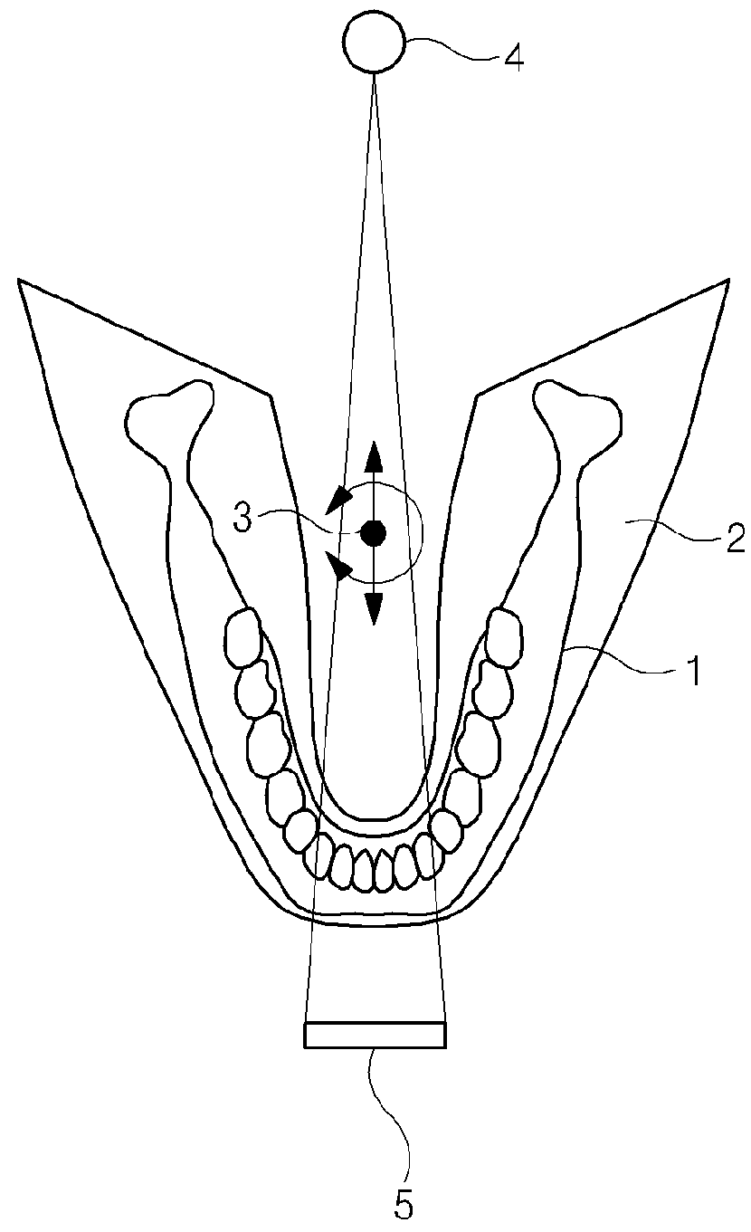 X-ray imaging device and X-ray imaging method