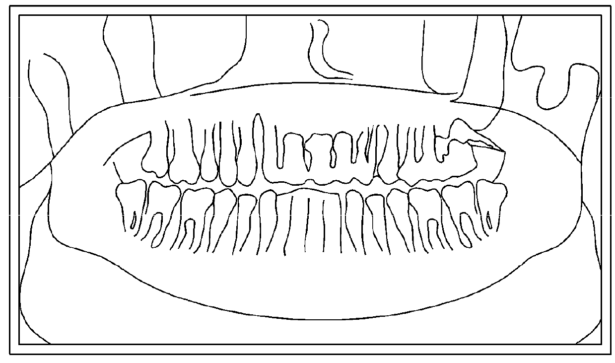 X-ray imaging device and X-ray imaging method