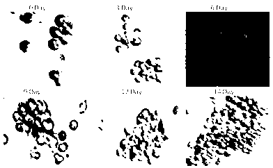 Kit for separated culture of DC-CIK cells, and application thereof