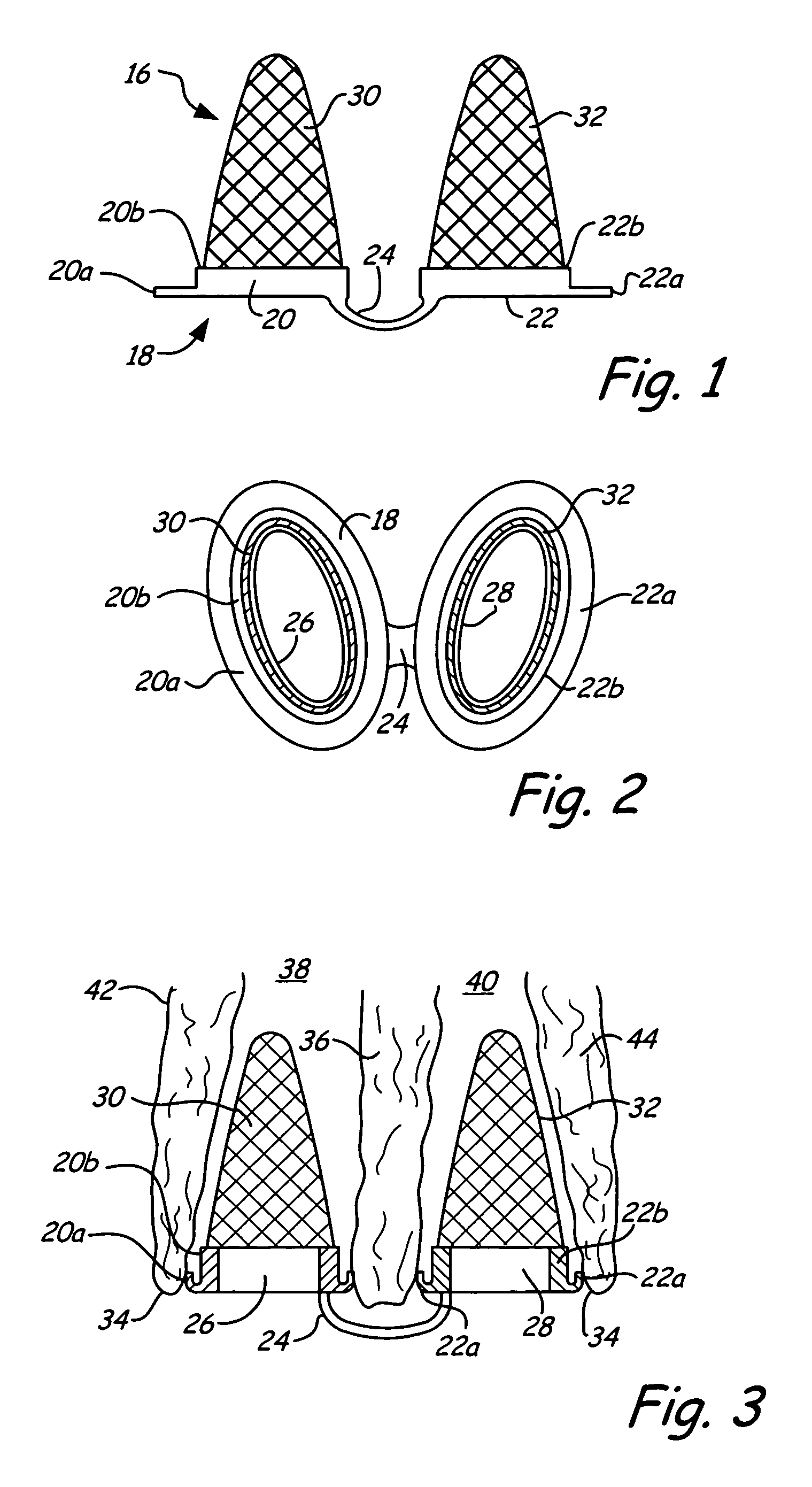 Breathing air filtration devices