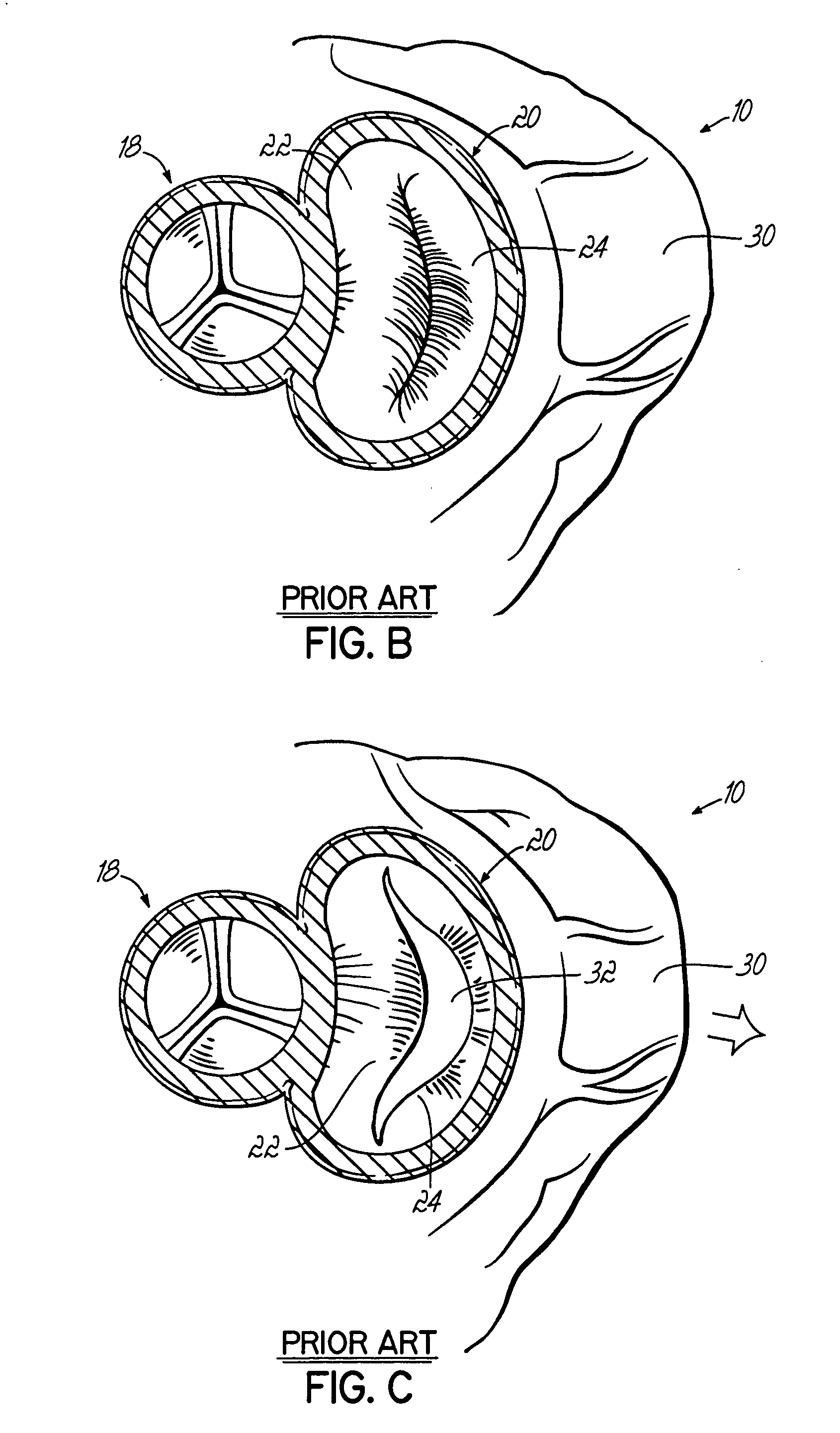 Tissue fastening systems and methods utilizing magnetic guidance