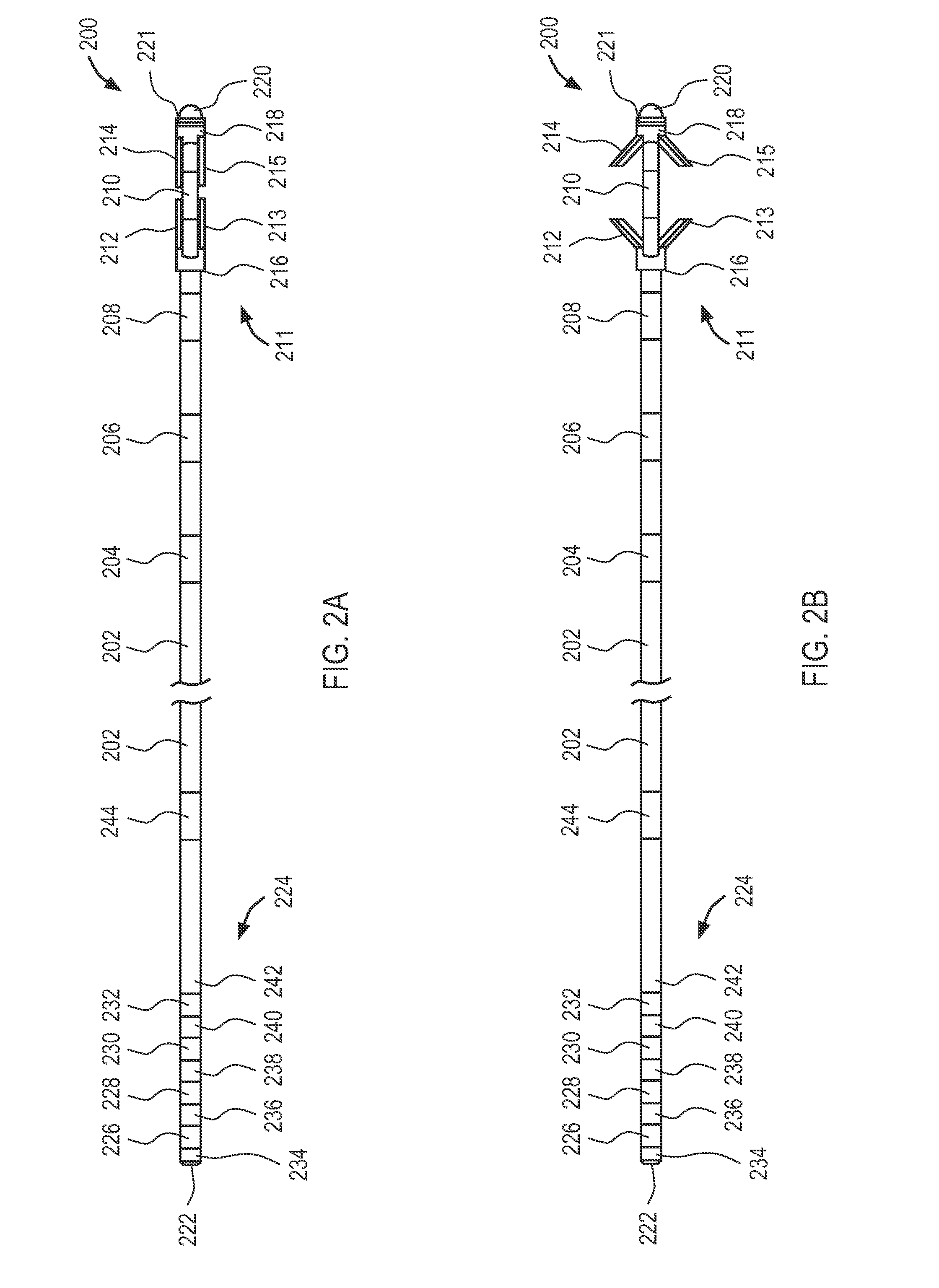 Systems and methods for implanting electrode leads for use with implantable neuromuscular electrical stimulator