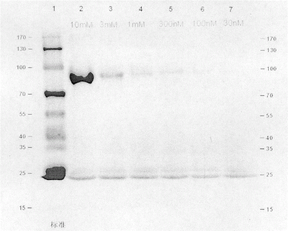 Photoaffinity labeling marker probe molecule for marking serum glycogen phosphorylase concentration level as well as preparation method and medical application of photoaffinity labeling marker probe molecule