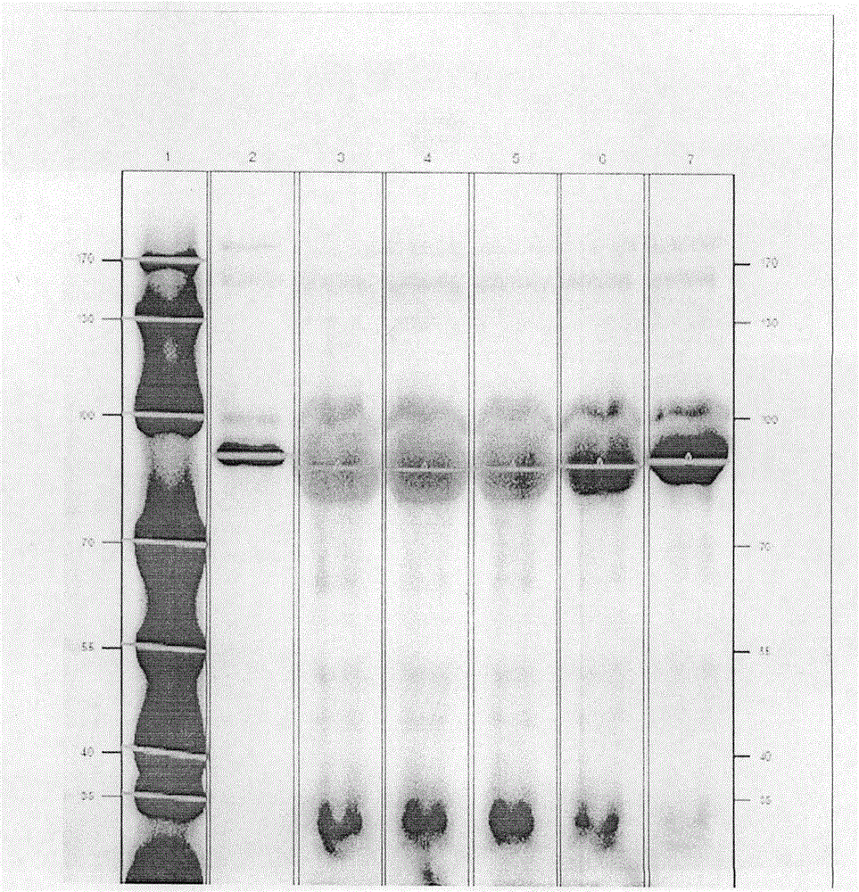 Photoaffinity labeling marker probe molecule for marking serum glycogen phosphorylase concentration level as well as preparation method and medical application of photoaffinity labeling marker probe molecule