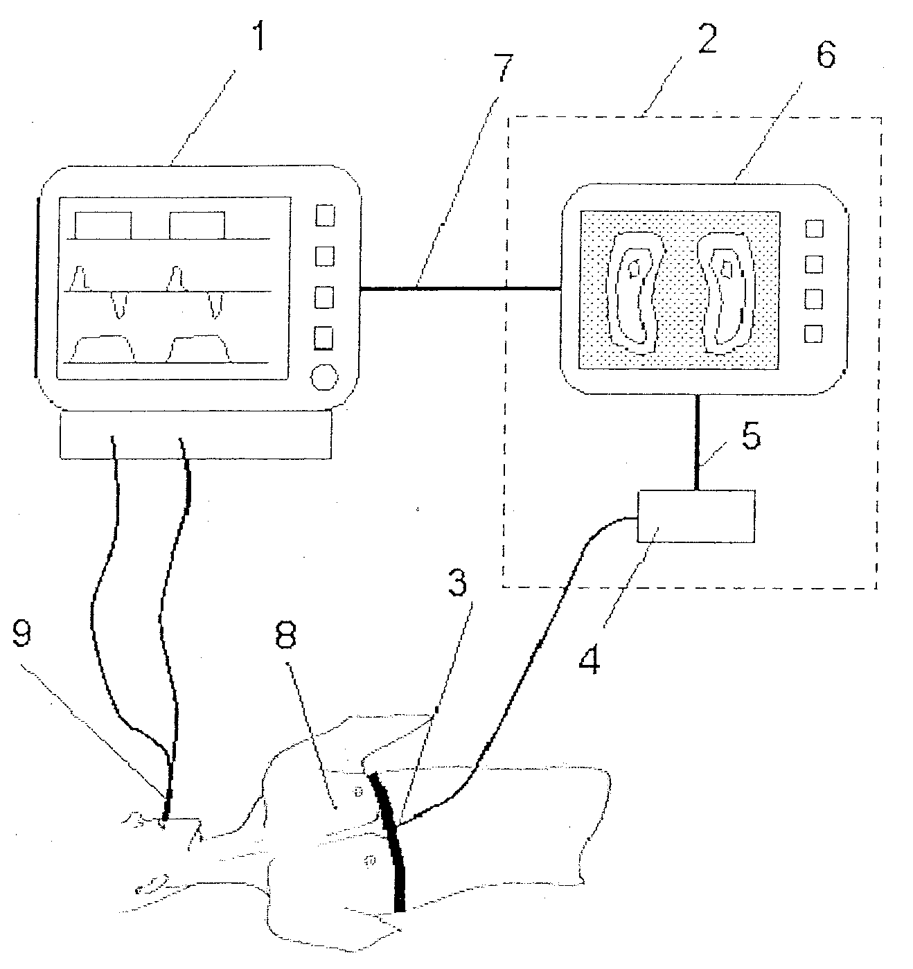 Process and device for lung ventilation