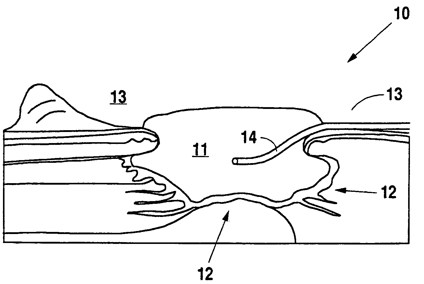 Negative pressure wound therapy system with provision for introduction of an agent