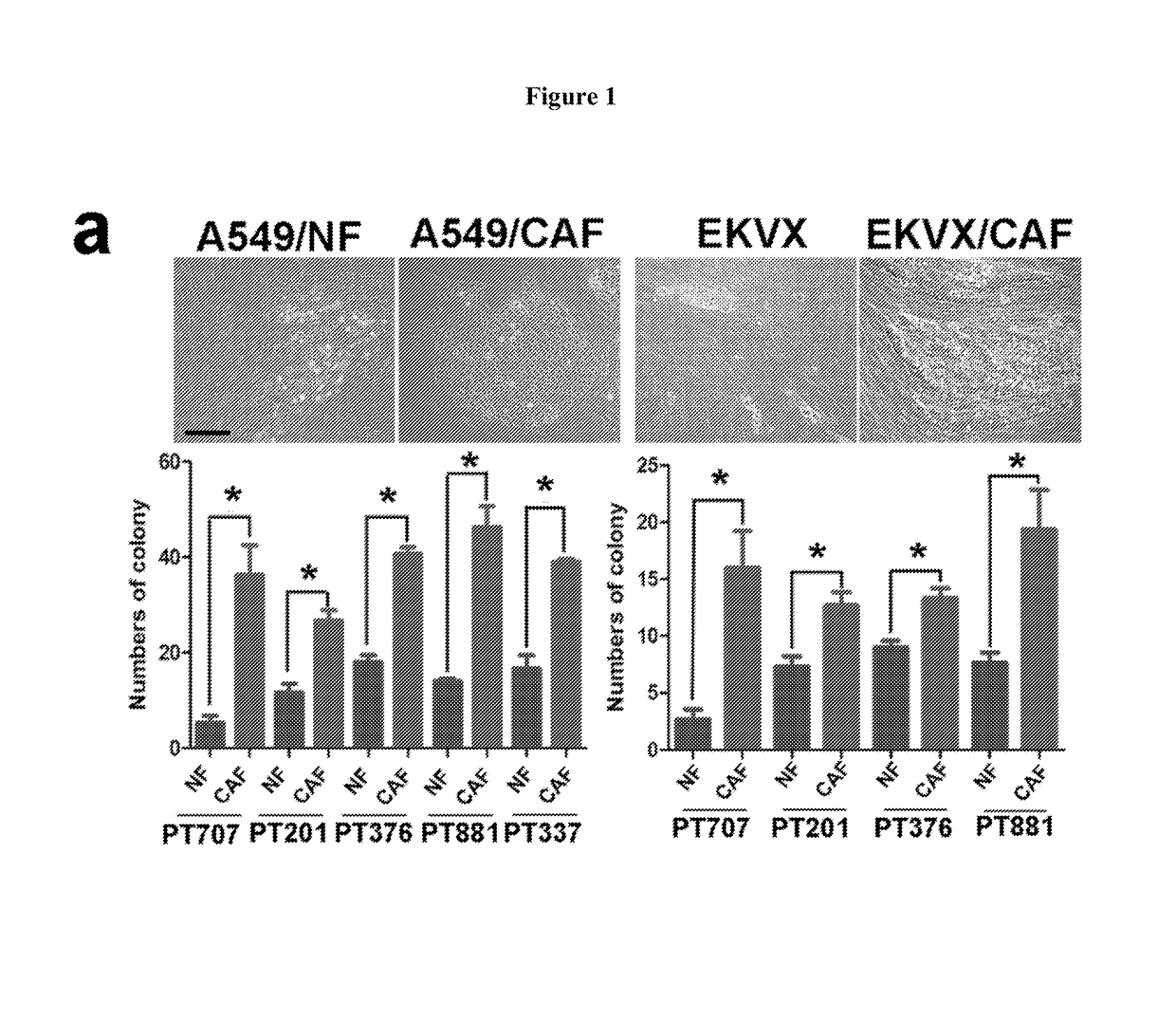 Cancer-associated fibroblasts in maintaining stemness of cancer stem cells