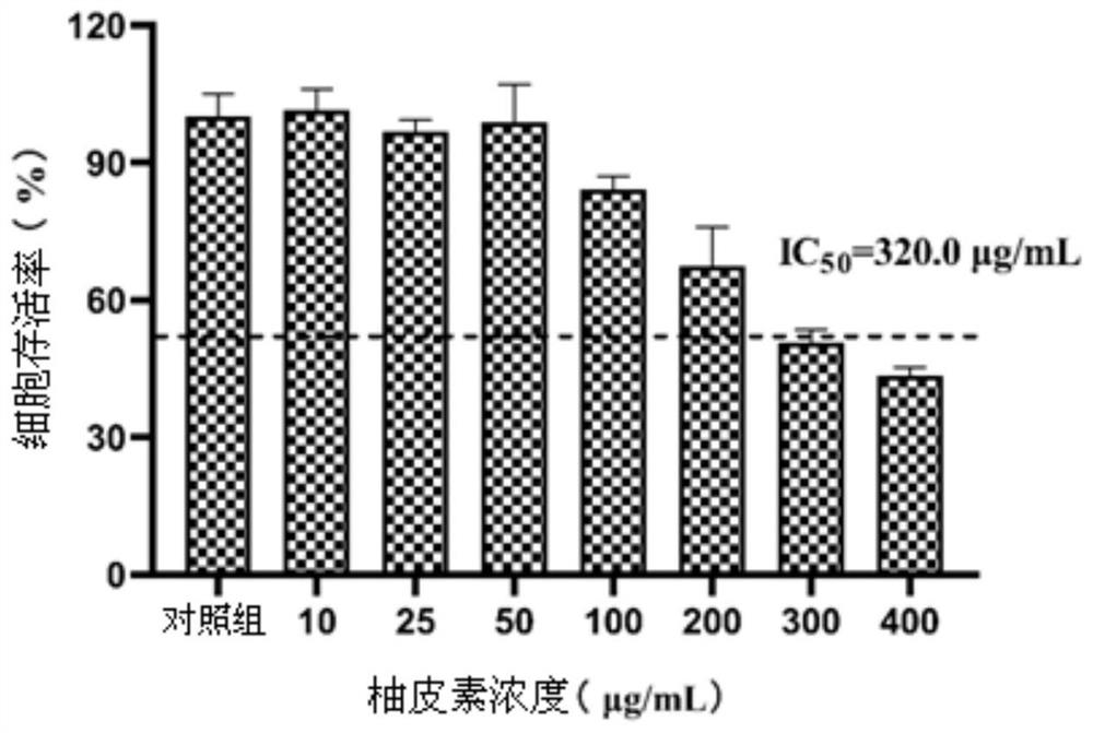 Application of naringenin and naringenin composition in preparation of medicine for treating or preventing toxoplasmosis