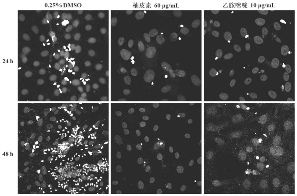 Application of naringenin and naringenin composition in preparation of medicine for treating or preventing toxoplasmosis