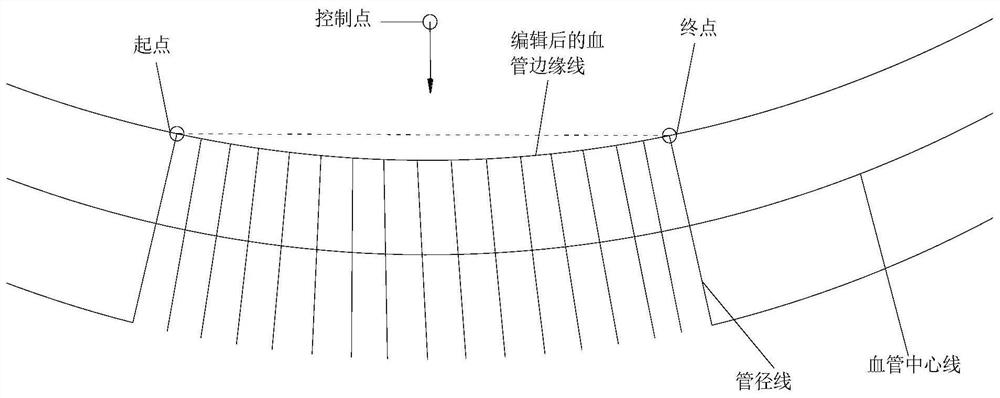 Editing method and editing device for edge line of retinal blood vessel