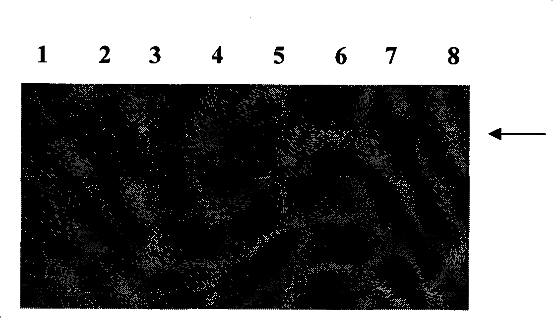 Nucleic acid enzyme surface protein of streptococcus suis 2-type and preparation method and application thereof