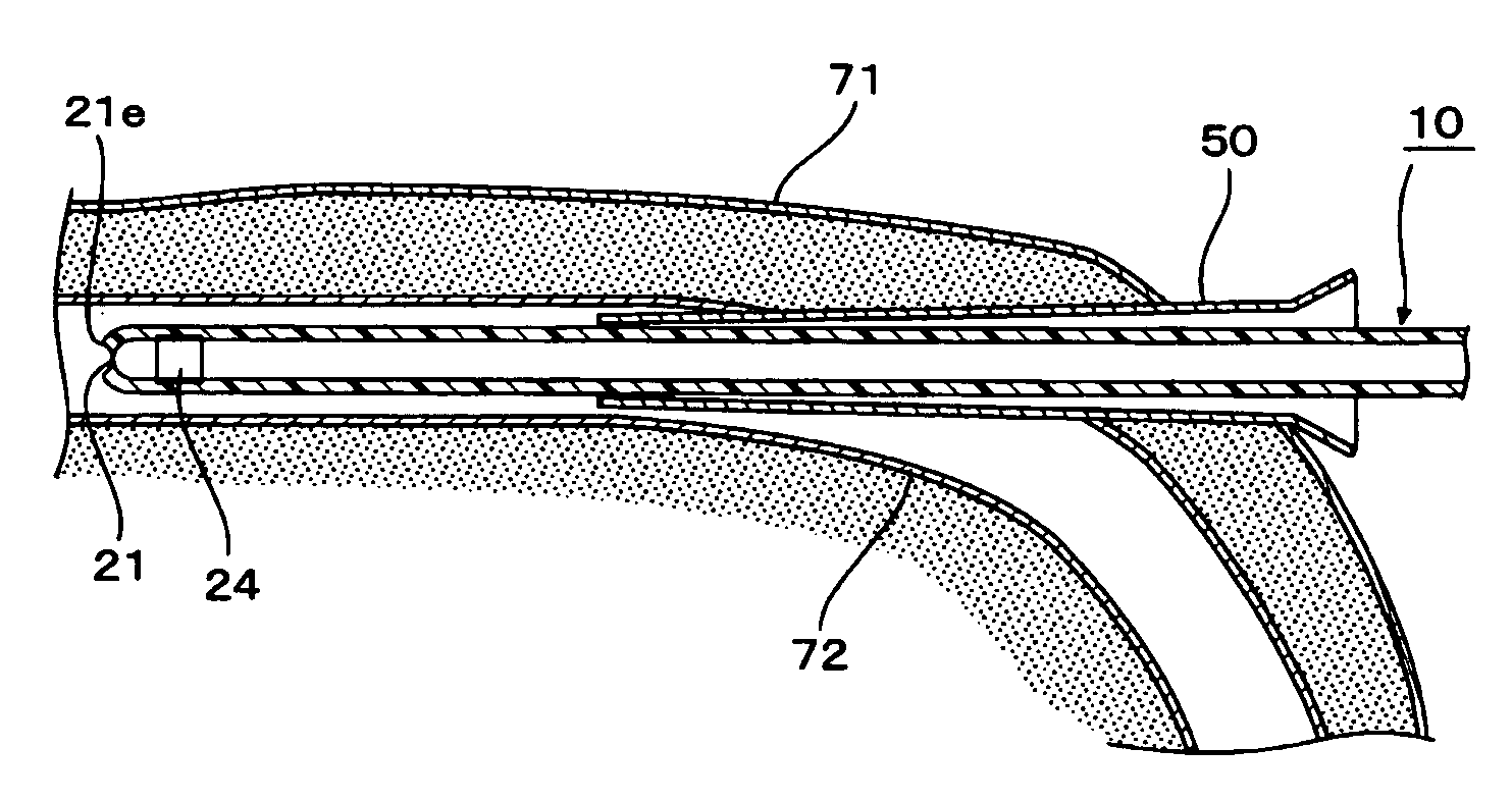 Drug solution infusion catheter