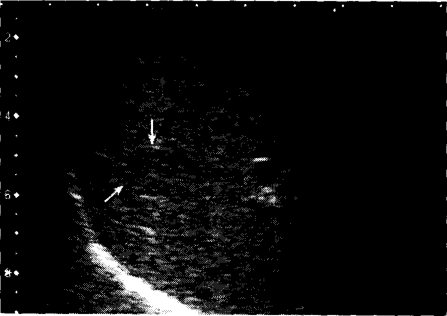 Method for improving resolution of ultrasonic image-forming image, and ultrasonic contrast image-forming apparatus