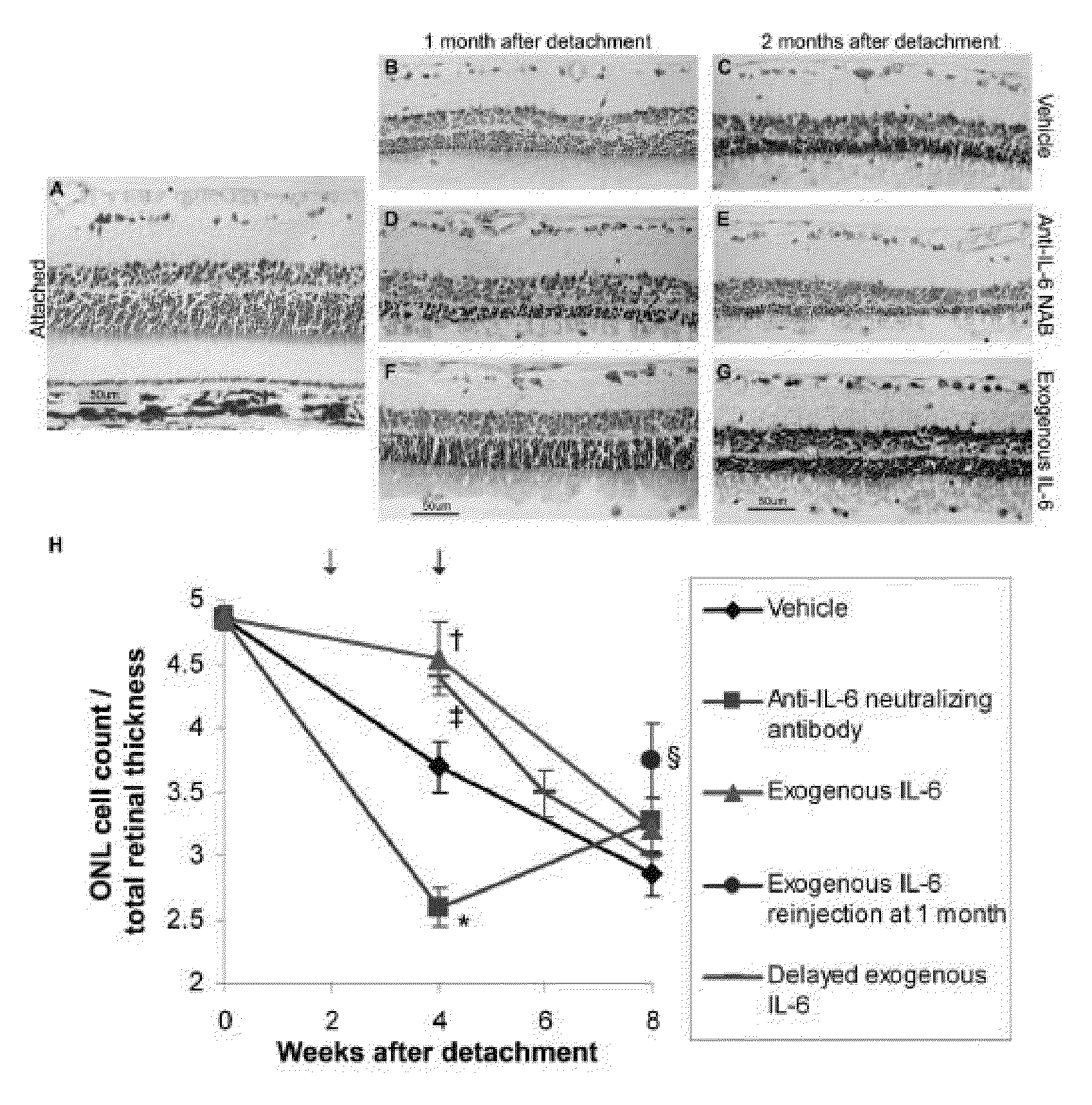 Methods of inhibiting photoreceptor apoptosis