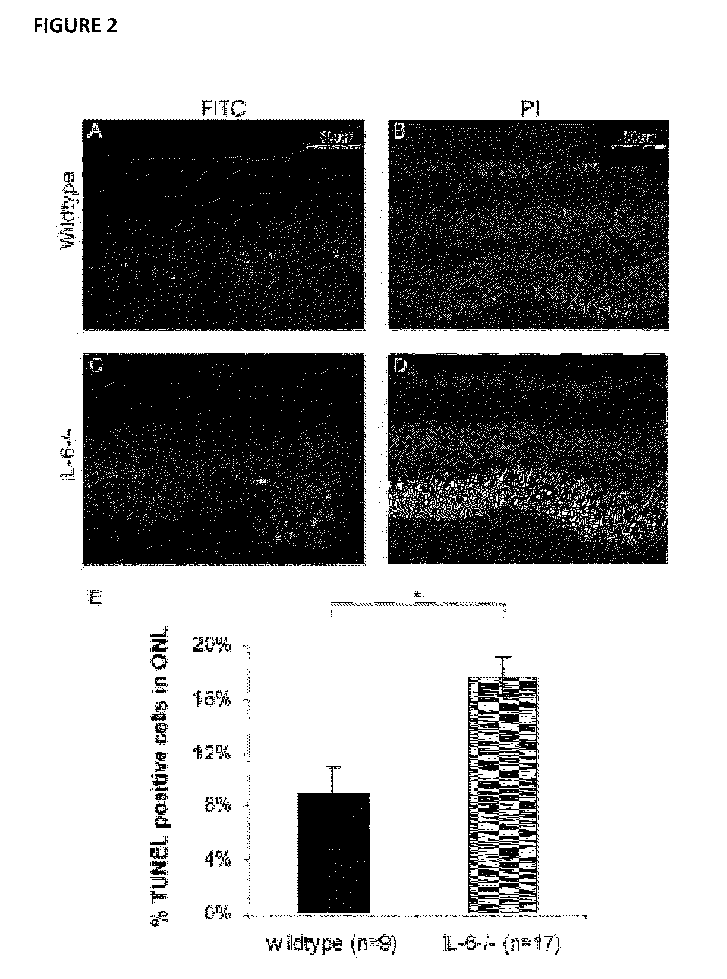 Methods of inhibiting photoreceptor apoptosis