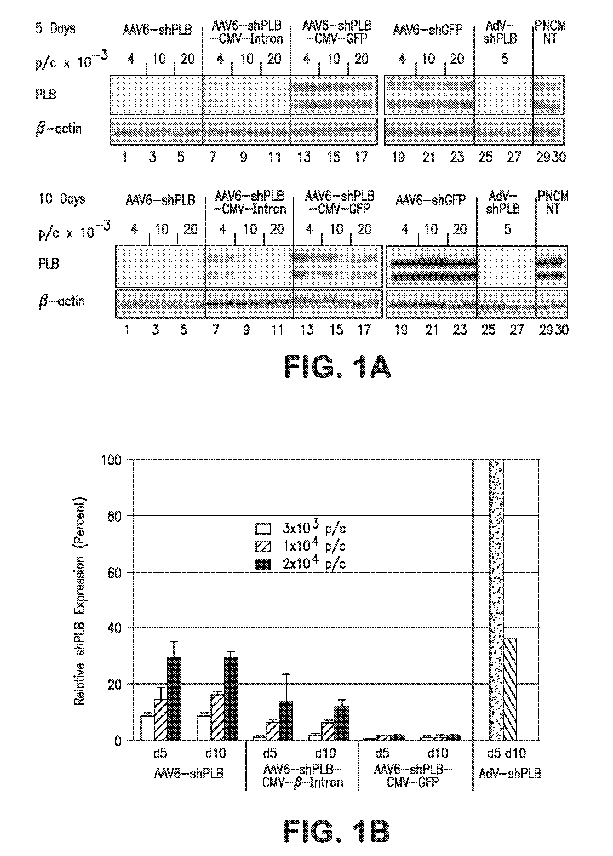 RNA Interference for the Treatment of Heart Failure