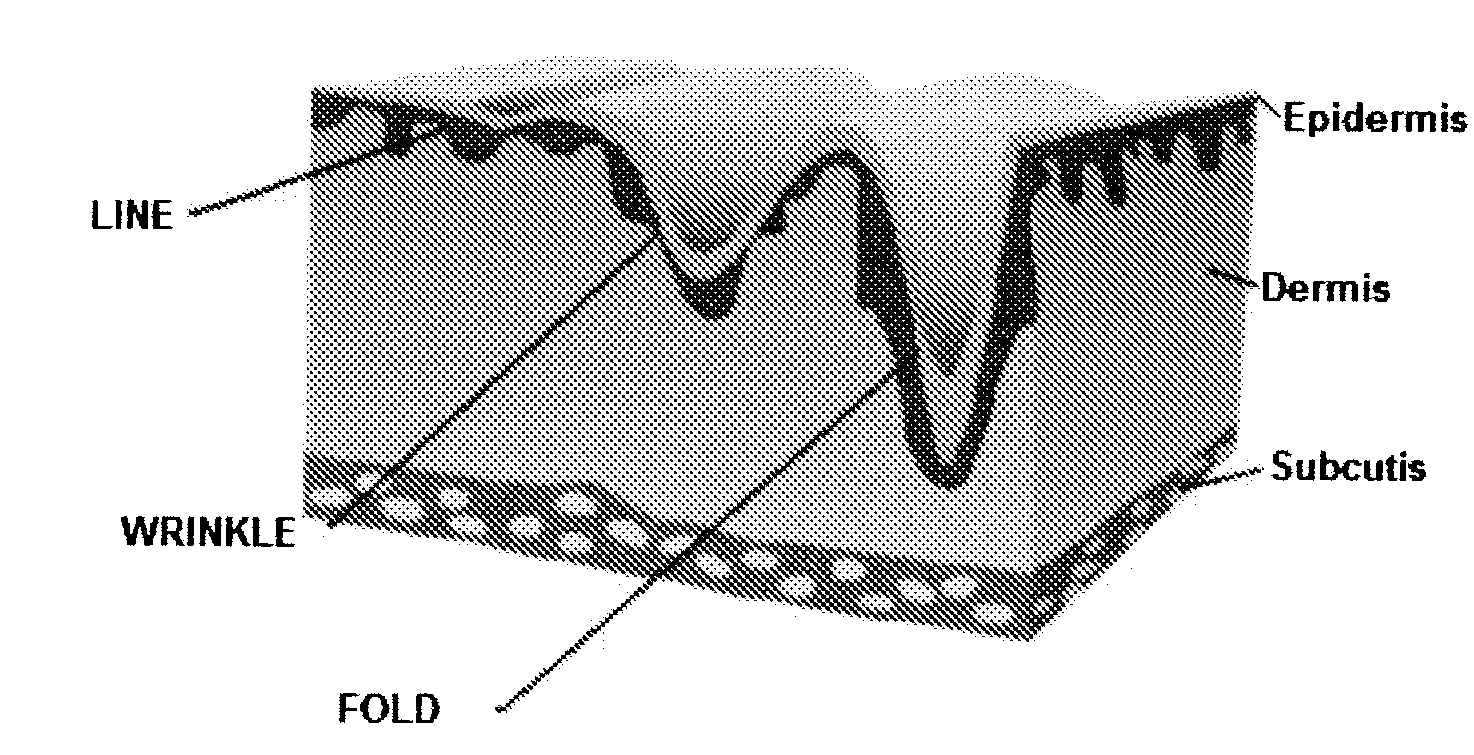 Coated Hyaluronic Acid Particles