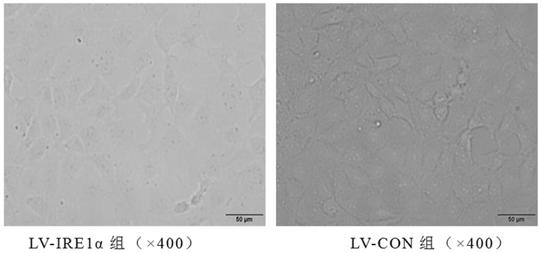 A drug for parenteral nutrition-related liver disease