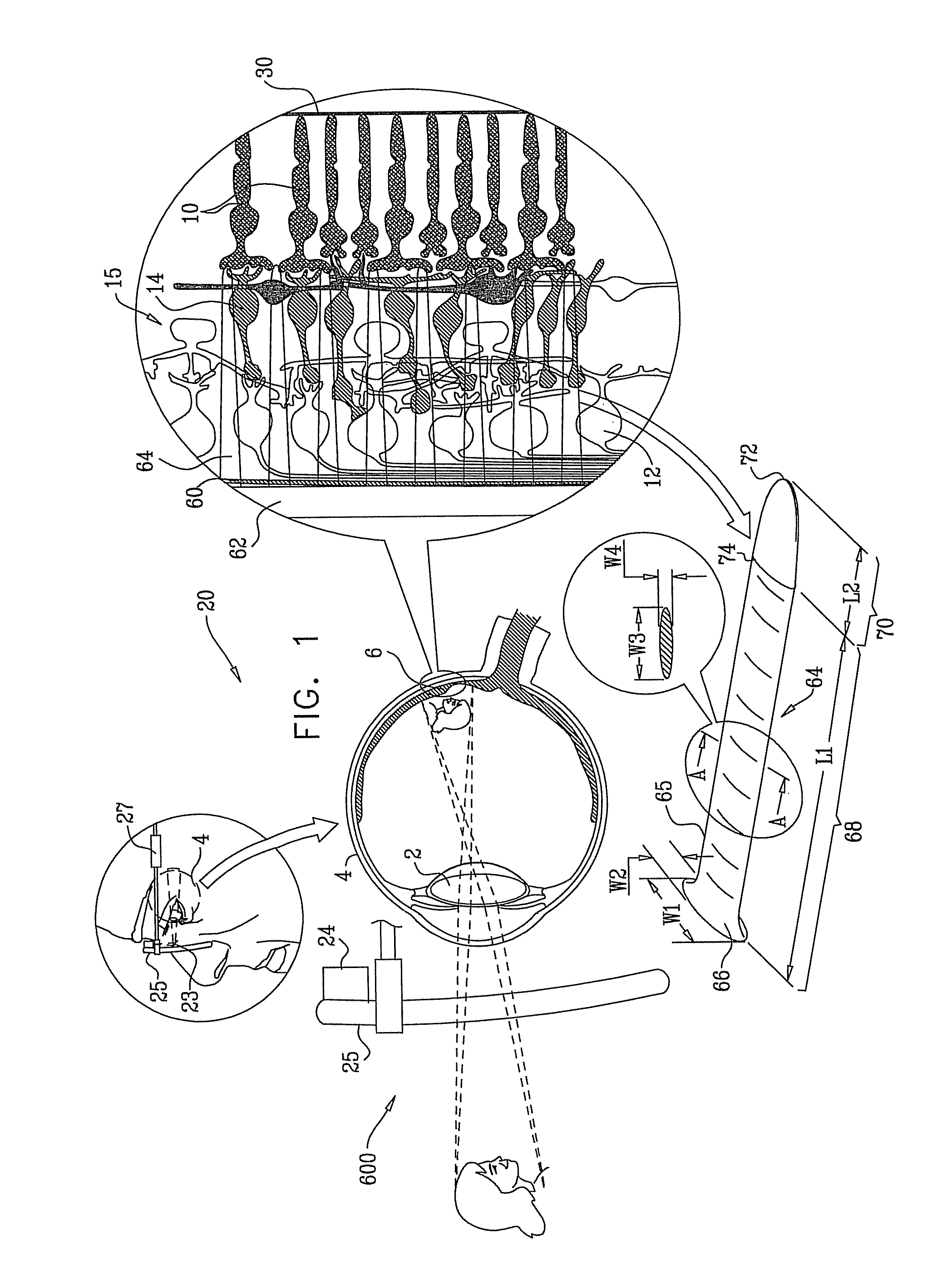 Retinal prosthesis techniques