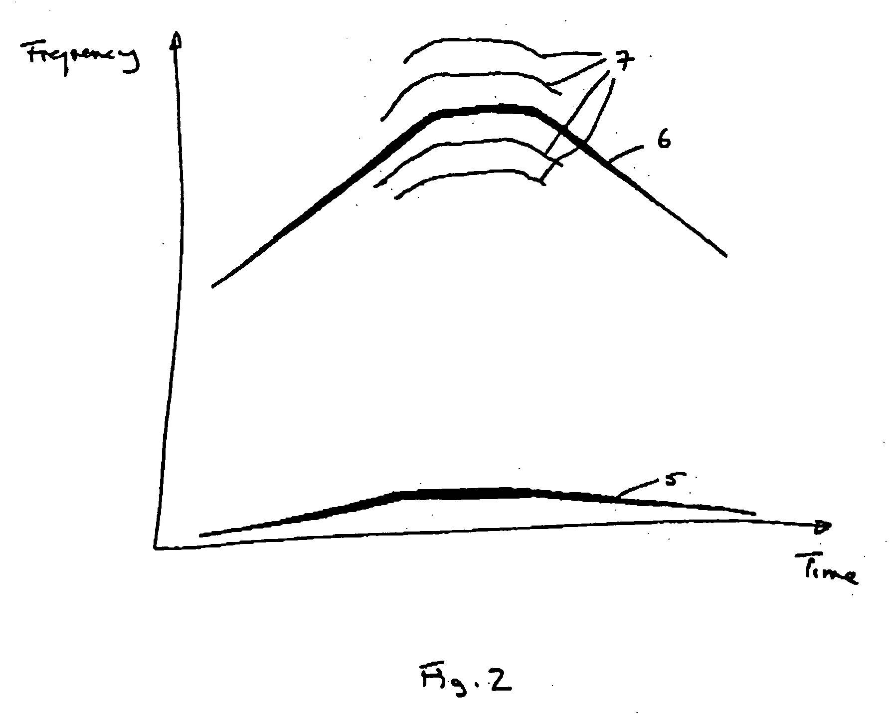 Bearing anomaly detection and location