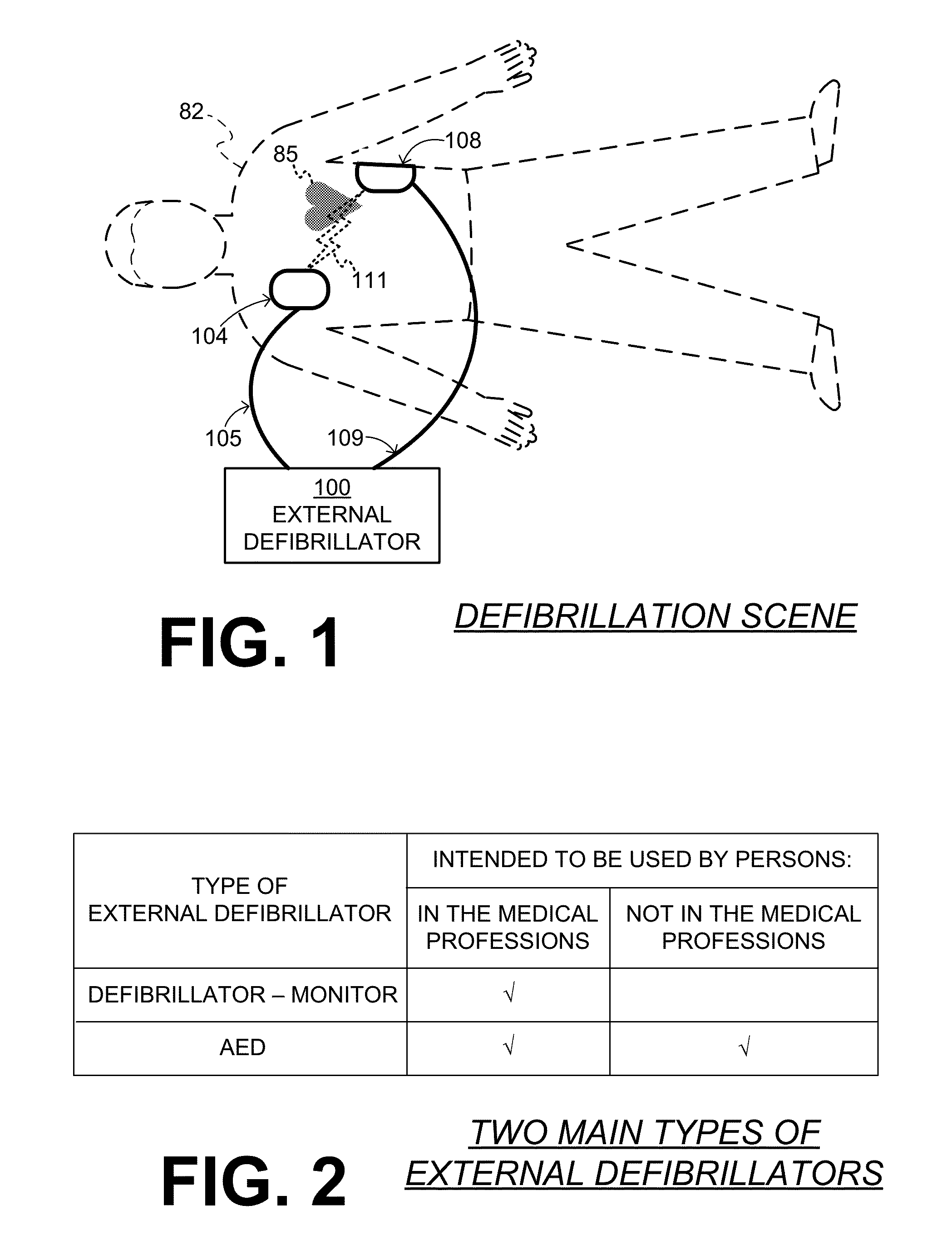 System and method for electrocardiogram analysis and optimization of cardiopulmonary resuscitation and therapy delivery