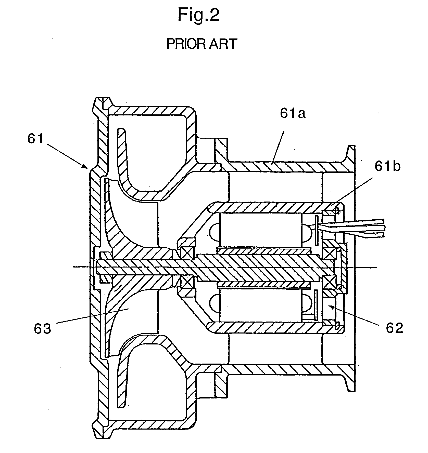 Motor-driven supercharger