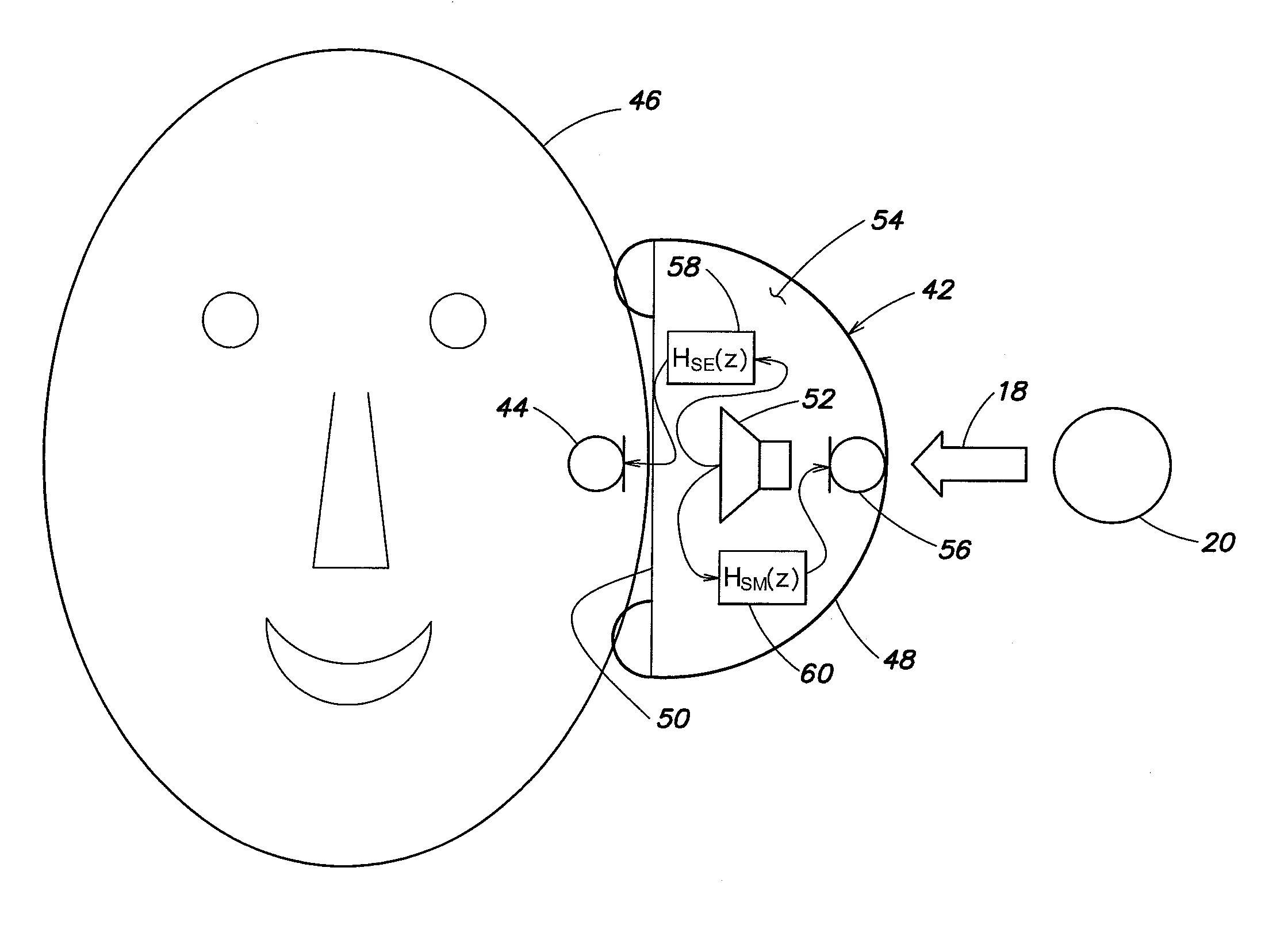 Active noise reduction system