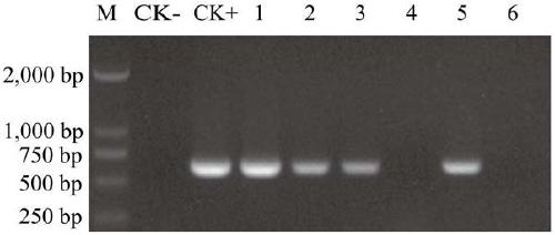 2-methyl citric acid high-yield genetic engineering bacterium and construction method thereof