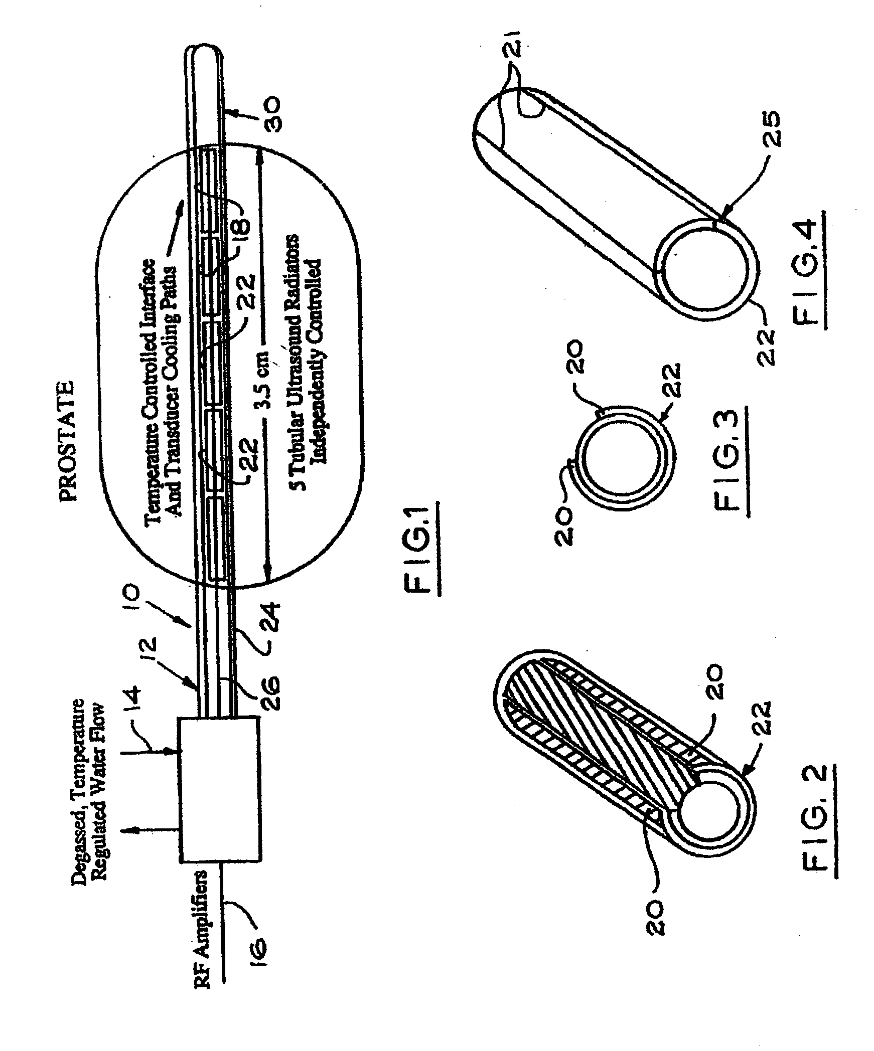 Method of manufacture of a transurethral ultrasound applicator for prostate gland thermal therapy