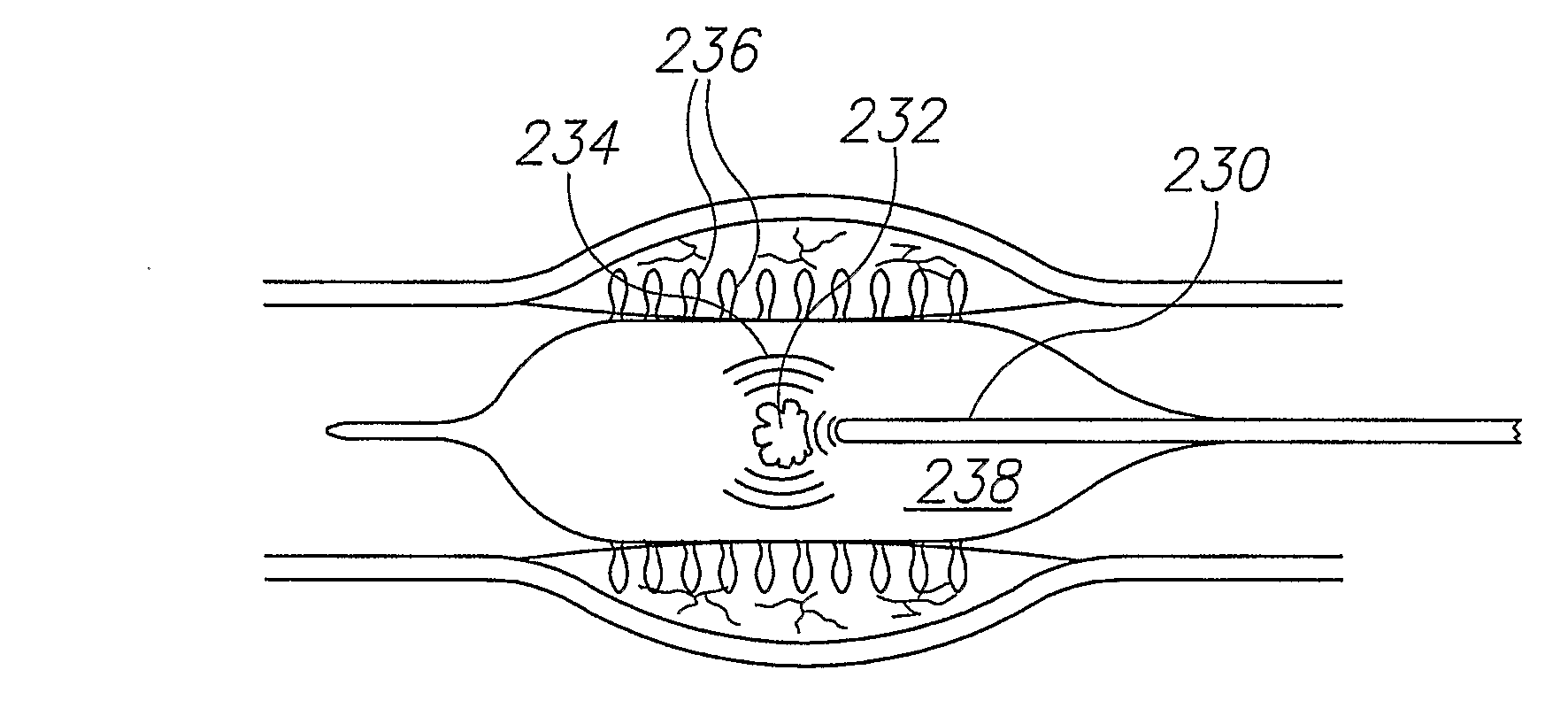 Material Delivery System