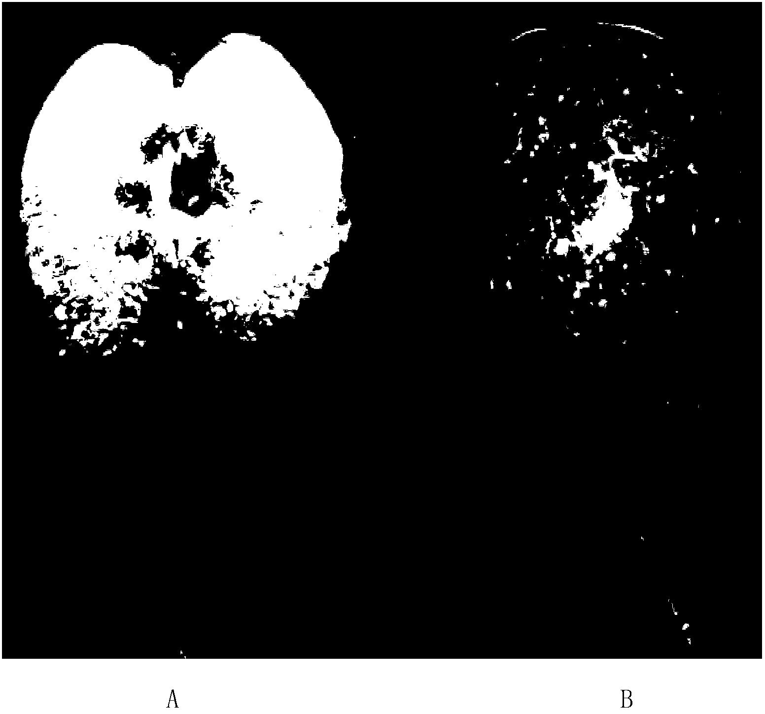 'Three-selection, two-advancing and one-promotion' apple breeding method