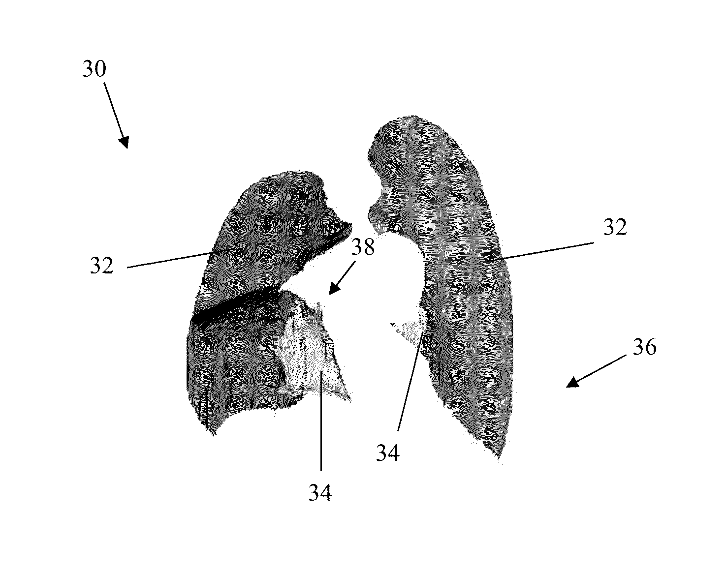 Visualization and characterization of pulmonary lobar fissures